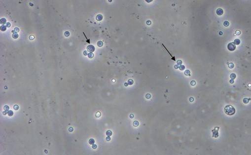 酵母双杂交技术原理、试验流程、特点以及应用