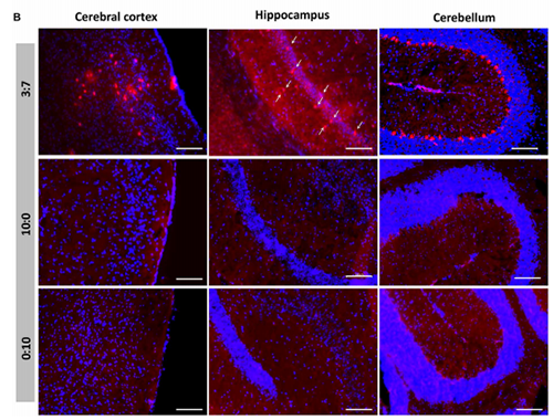 被包裹在含有NT-类脂质的LNP中的Cre重组酶成功转移。大脑中的转染神经元呈红色高亮。