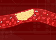 【Science速递】攻克COVID-19里程碑：已确定血凝块形成原因！