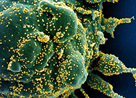 唾液检测新冠抗体新方法来了，获取结果仅需几小时！